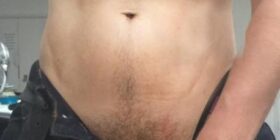 skin hunks holes meat