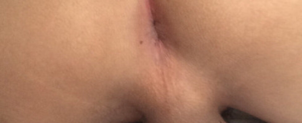 sometimes you will get a new bottom with an anus